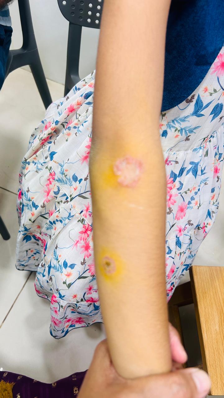 Pediatric Skin Disease Treatment